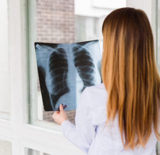 A female doctor examines an x ray of shot of the lungs. View from the back