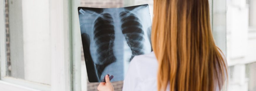 A female doctor examines an x ray of shot of the lungs. View from the back
